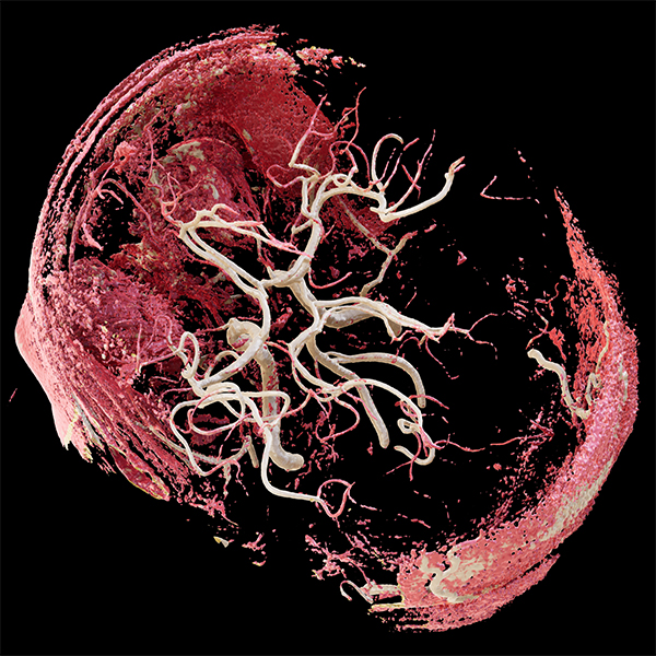 Viewtify Circle of Willis